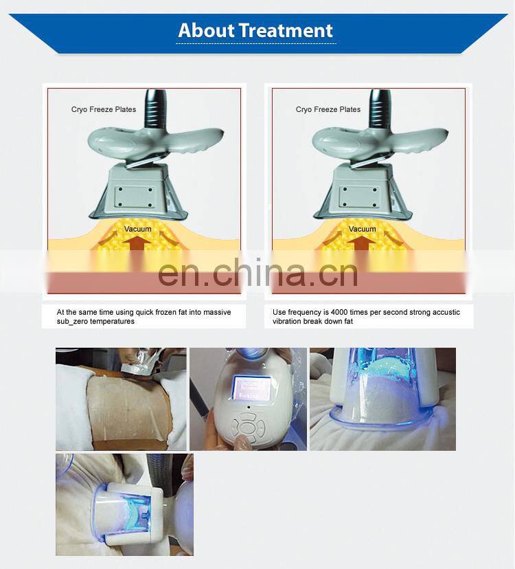 Renlang Top Seller Fat Reduction Device Fat Freeze Portable Slimming Machine