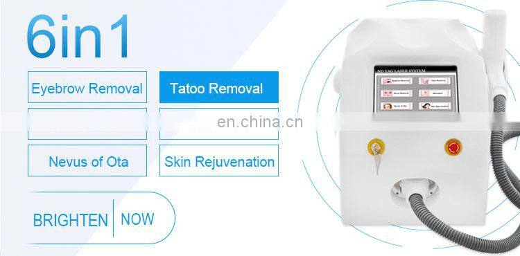 Fast treatment effect ND YAG Q- Switched tattoo removal machine ND Yag painless laser tattoo removal machine