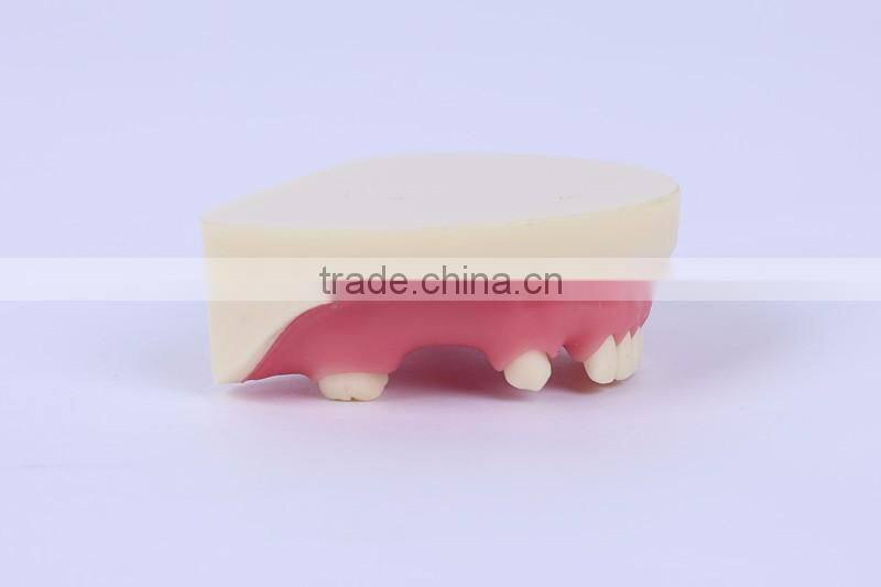 New Type Good Quality Dental Implant Model with teeth