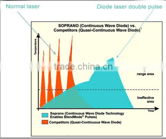 Y9D-Ydel CE certification 808nm diode laser hair removal machine