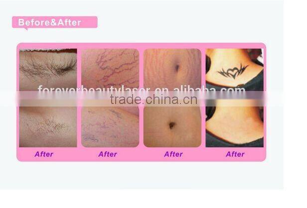 Professional Dehairing Treatment Device EPL100 promotion price on sale