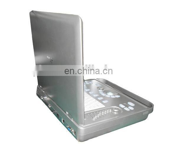 15 inch 2D/3D B/W Laptop digital portable ultrasound units