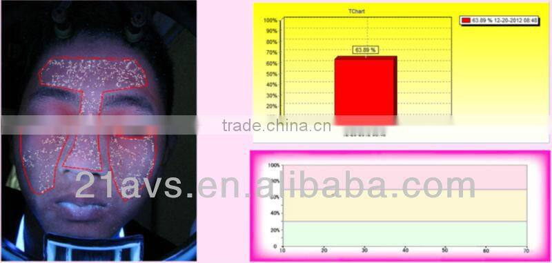 Professional Facial Skin Analyzer Magic Mirror with software system for beauty salon