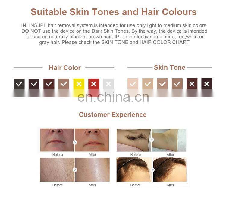 New beauty device ipl laser hair removal device at home use