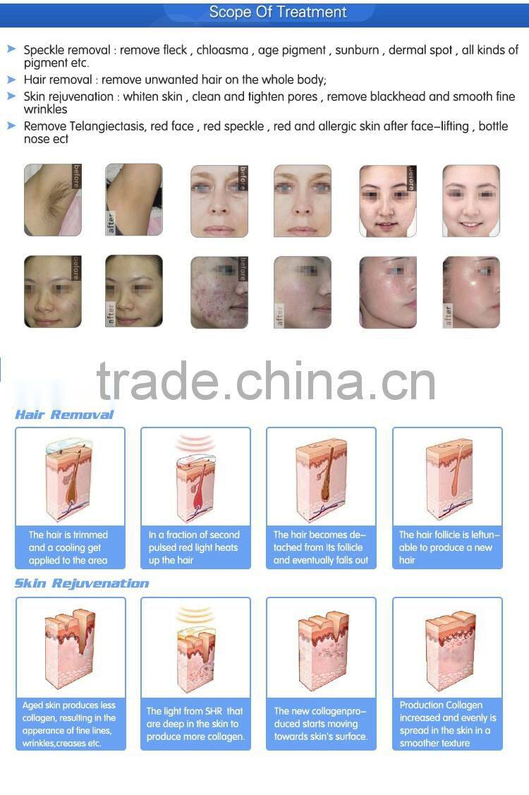 2016 newest!! professional shr ipl laser hair removal machine for sale