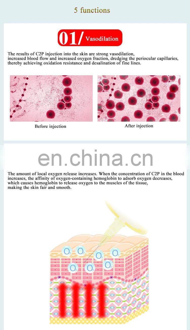 Hot Sale CDT carboxytherapy machine/carboxytherapy/carboxy therapy equipment