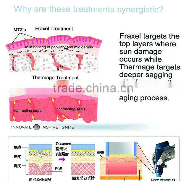 F998 Anti-aging Fractional RF Microneedling Face Treatment