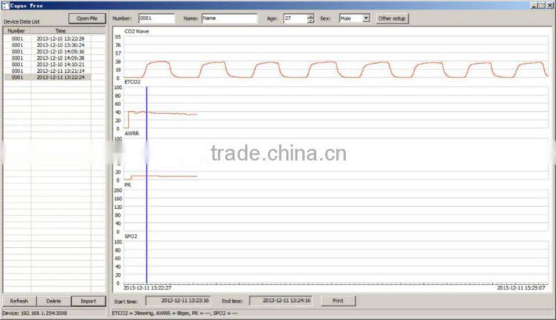 2016 Newest and Cheapest Handhold ETCO2&SPO2 Monitor with Large screen for first-aid MSLMP05A