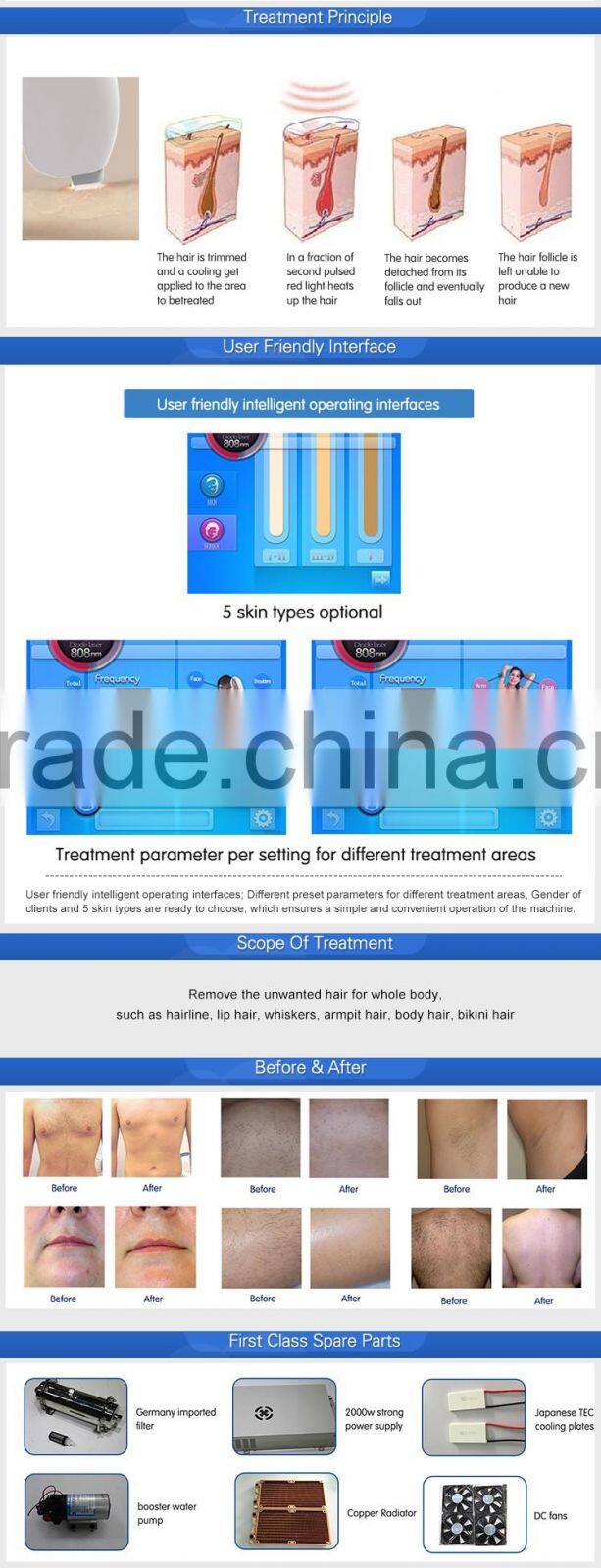 808nm laser vertical type diode laser for hair removal 808nm beauty machine depilight