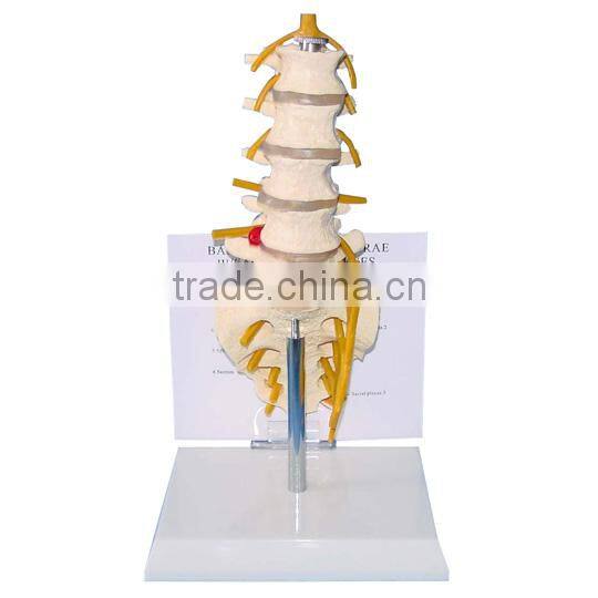 Desktop Lumbar Vertebra Model