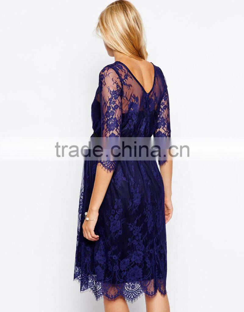 Maternity Lace Midi Dress With Scalloped Detail