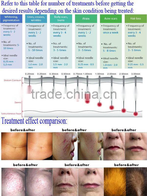 Guangzhou factory selling derma roller/microneedles dermaroller with great quality