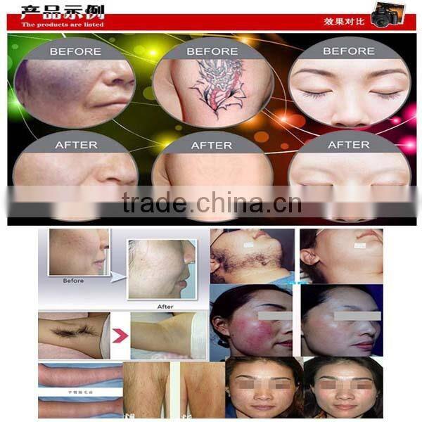 Yes Q-Switch laser e light ipl machine