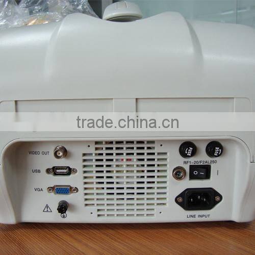 RUS-6000A Best Sale Hospital Clinic Portable Ultrasound Machine/Scanner with convex, transvaginal, linear, rectal probe-Shelly