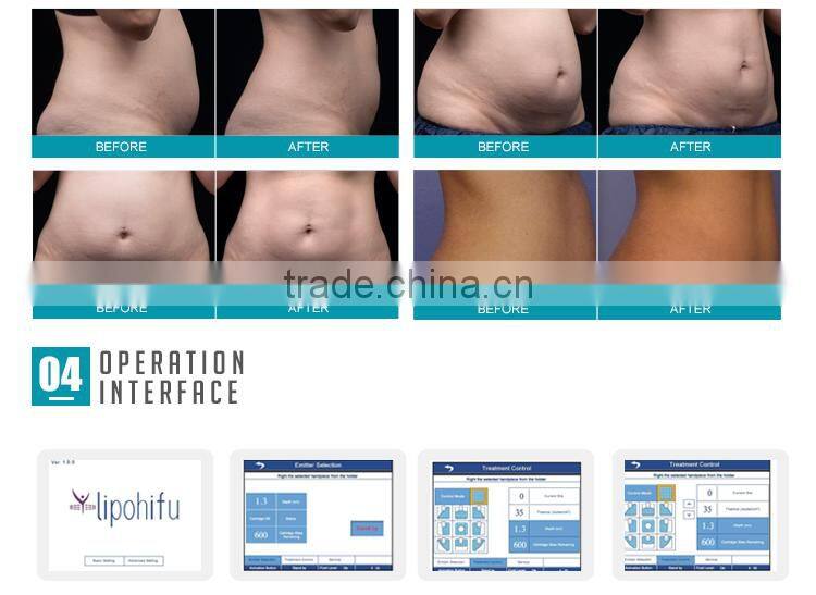 2016 portable ultrasonic