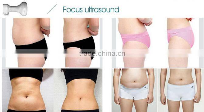 2016 portable HIFU shaping and face lifting machine/ limming beauty machine RF + vacuum slimming weight loss