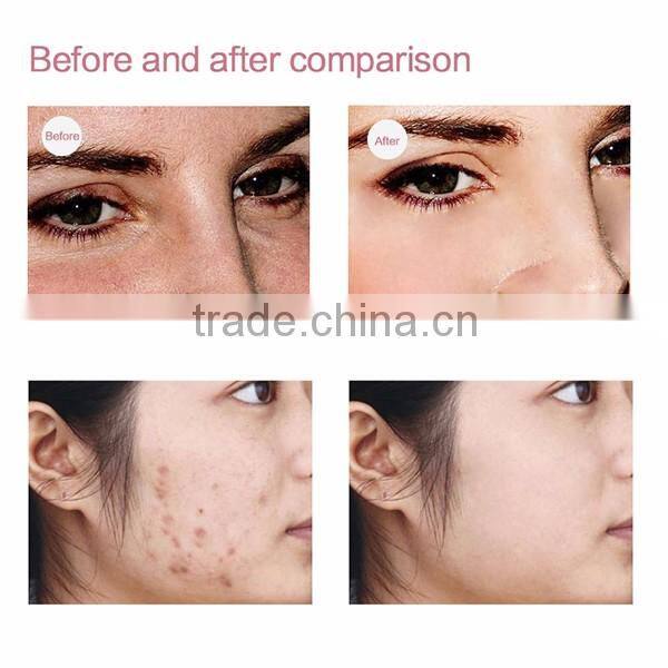 EYCO red light device led light therapy for face fractional red light therapy mask