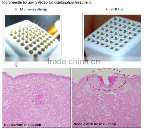 2 professional treatment handles radiofrecuencia fraccionada