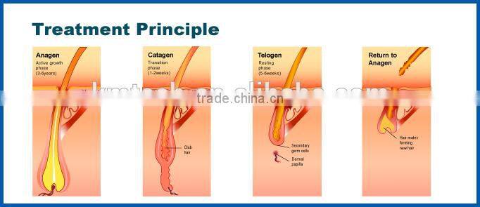 elight ipl machine manufacturers looking for distributors