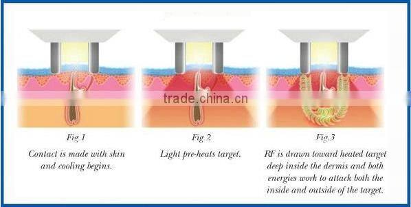2014 New multifunction beauty device with CE ISO TUC FDA