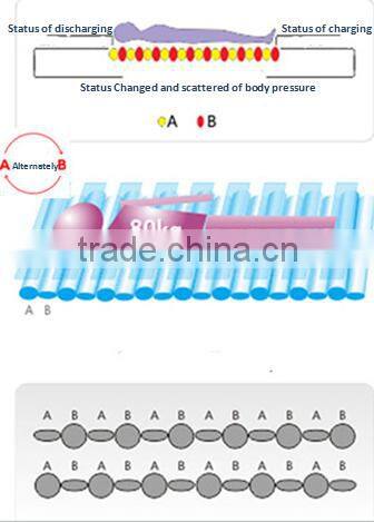 china new good quality and medical alternating pressure air mattress