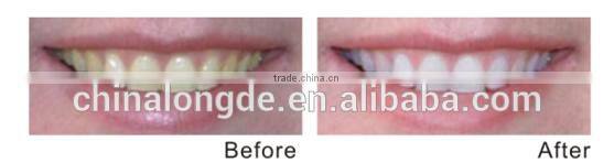 2016 dental unit model teeth whitening system best quality dental bleaching lamp AM209B