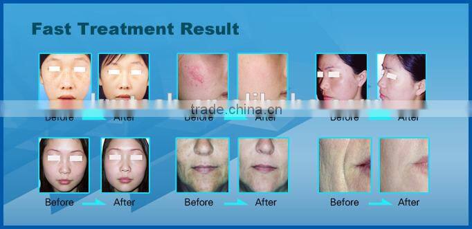 Professional 5 in 1 multifunctional beauty equipment