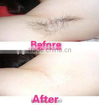 808nm diode laser Hair Removal Machine with Professional CE certificate