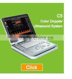 Sonostar good quality handheld portable vet ultrasound scanner pig veterinary ultrasound V6