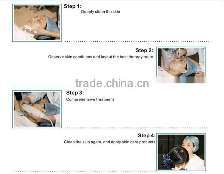 Professional HFU facial contouring best-sale High Intense Focus Ultrasound HFU10