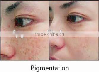 IPL+RF+ND YAG ipl/rf/tattoo beauty machine