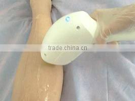 KLSi on Sale Diode Laser Hair Removal Machine