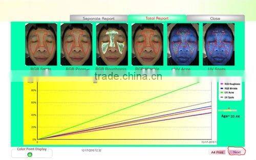 WT-01-S Portable Magic Mirror skin diagnosis system