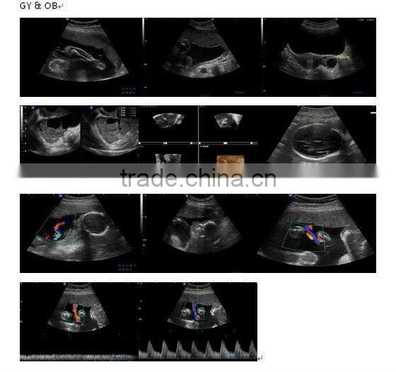 Abdominal/ Vascular/OB/GYN/4D Ultrasound iSpark 480 with CE Approved