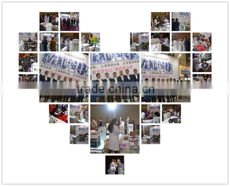 New design ipl shr opt laser permanent ipl laser removal