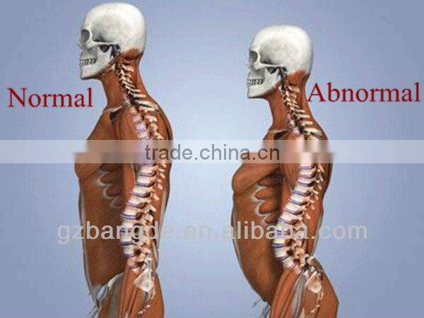 Professional medical therapy chiropractic adjusting instrument massager BD-M005