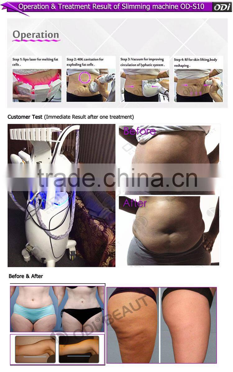 2016 lipo face cavitation 40khz laser liposuction machine