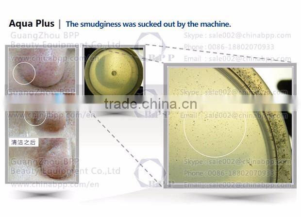 Beauty salon skin peeling diamond tips for hydro dermabrasion water oxygen jet peel machine