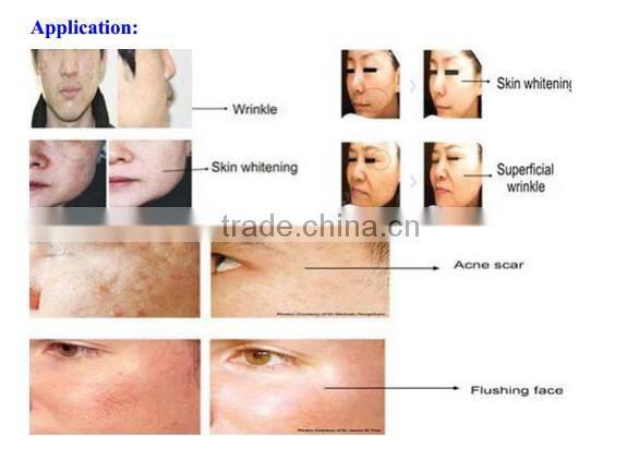 2016 PINXEL-2 Microneedle RF and Fractional RF beauty Machine/ ematrix sublative rejuvenation machine/ face machine infrared