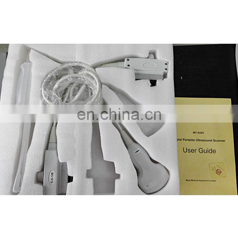 HC-A004 good quality mobile phone ultrasound scanner Digital portable ultrasound pregnancy scanner machine price