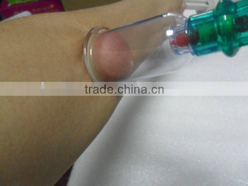 VY-01 Nice and good chinese cupping set for health care in