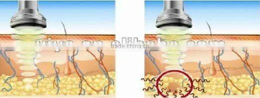 VY-M2 Hot sale ultrasonic body beauty slim massager machine