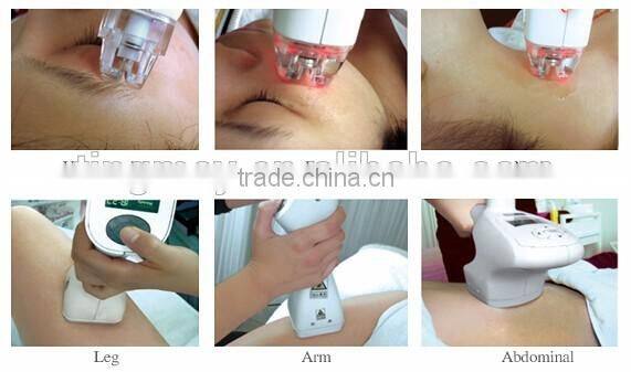 Vacuum RF Cavitation Infrared Laser Vacuum Roller Massage