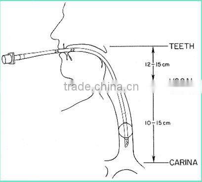 Competitive price DEHP FREE quick tracheostomy tube