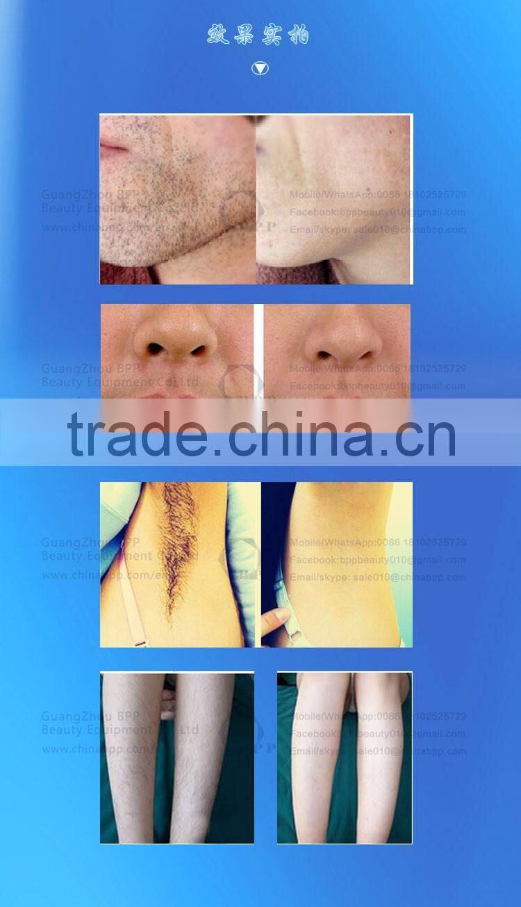 The advanced quantum hair removal machine with 808nm diode laser