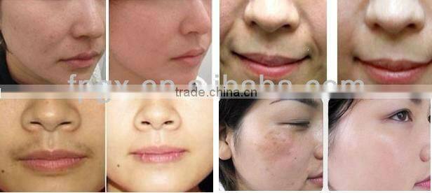Multifunctional E-light &RF 2in1 Hair Removal & Wrinkle Removal Beauty Equipment