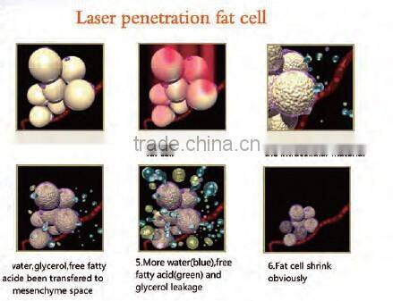 Top Design Fat Removal Lipo Cold Laser Slimming Machine