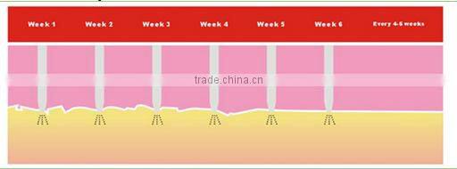 Skin younger facial exercise machine