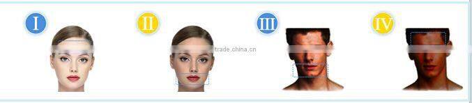 2016 vertical high performance 808 diode laser hair removal/808 laser hair removal machine