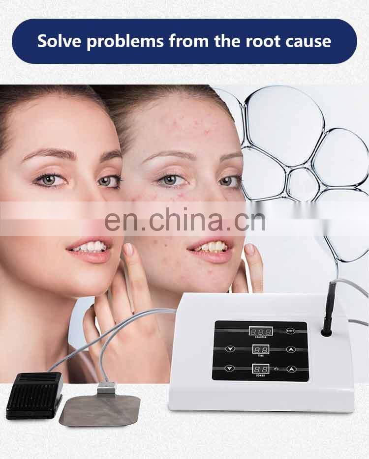 Hot selling best acne treatment acne scar removal blackhead removal beauty device